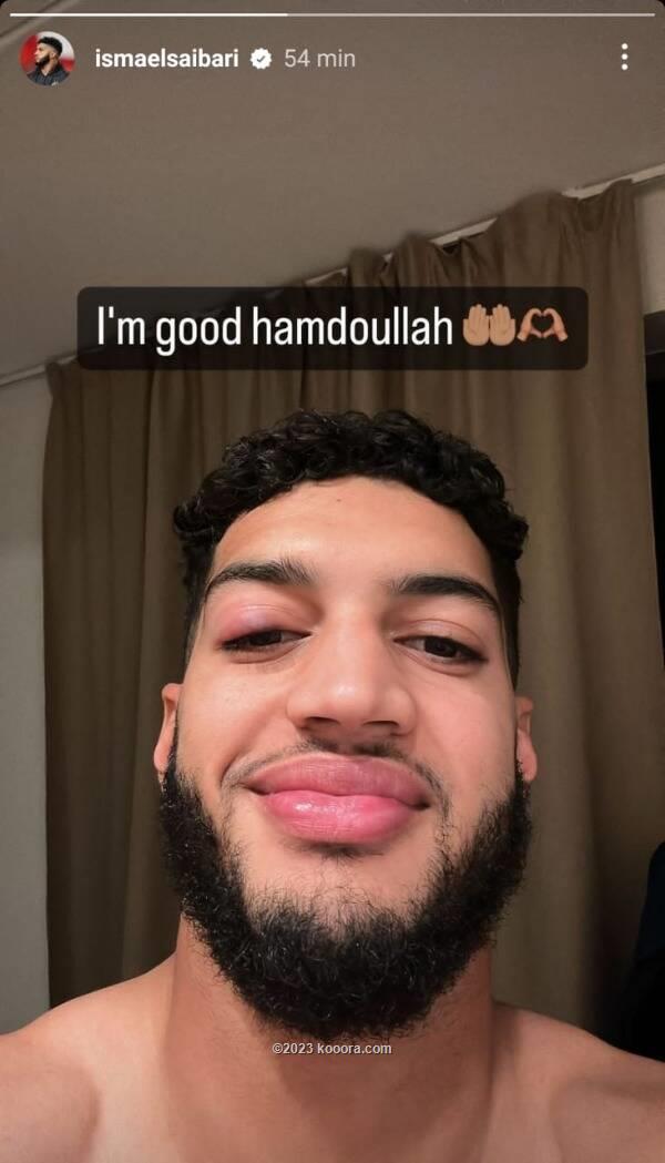 إصابة الدولي المغربي إسماعيل الصيباري نجم آيندهوفن الهولندي و اللاعب يرد على وليد الركراكي